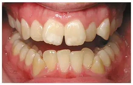 brace1-webp-900×300-
